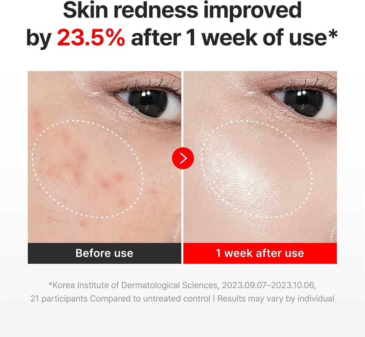 Madeca Time Reverse Cream – Anti-Aging Glow Moisturizer