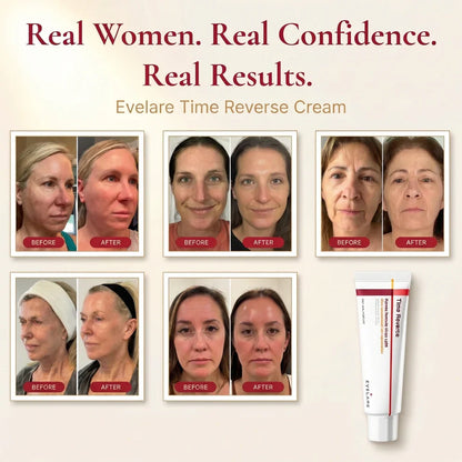 Evelare Time Reverse Cream – Anti-Aging & Skin Repair